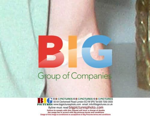 Dominic Monaghan With Broken Foot