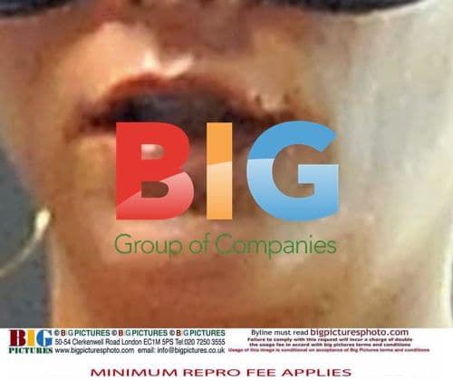 Victoria Beckham with Cold Sore