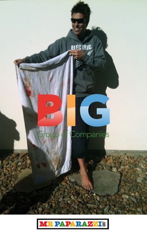 Surfer Survives Shark Attack in Byron Bay