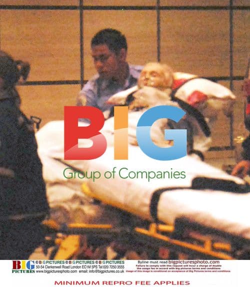 Zsa Zsa Gabor Leg Amputation