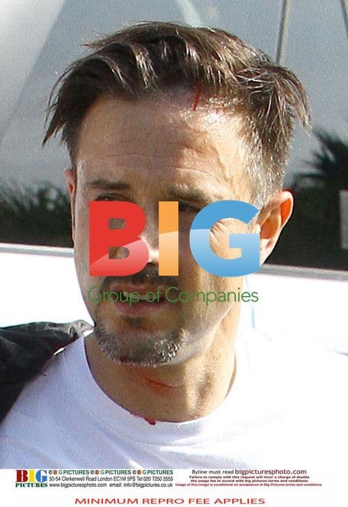 David Arquette Car Crash