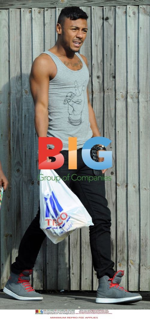 X Factor Contestants Teeth Whitening