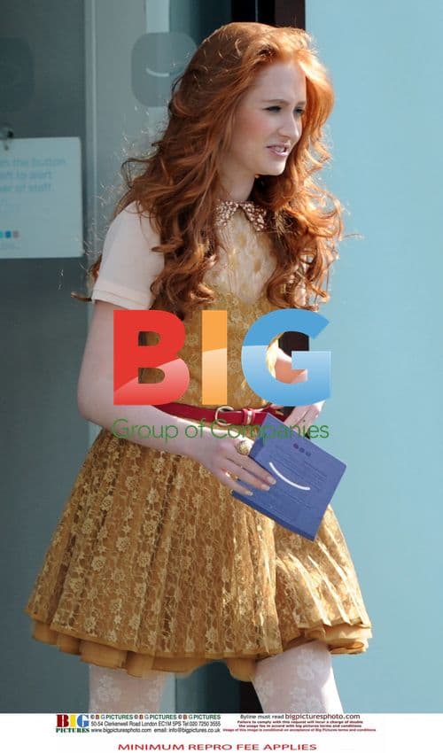 X Factor Contestants Teeth Whitening