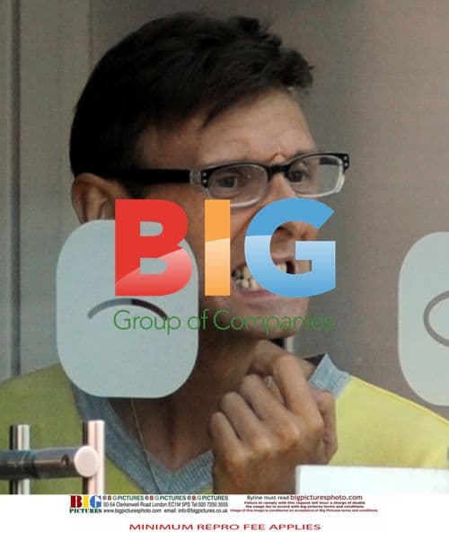 X Factor Contestants Get Teeth Whitened