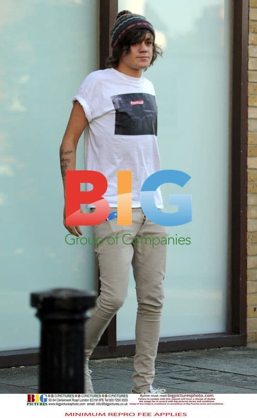 X Factor Contestants Teeth Whitening