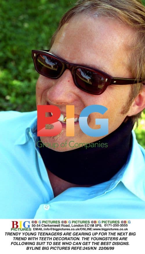 Teens Decorate Teeth for Next Trend