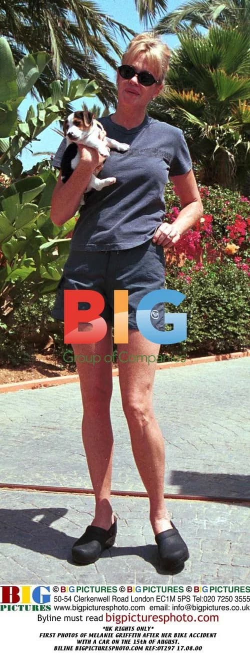 Melanie Griffith after bike accident