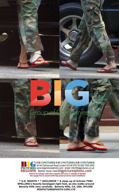 Tori Spelling's Bandaged Foot