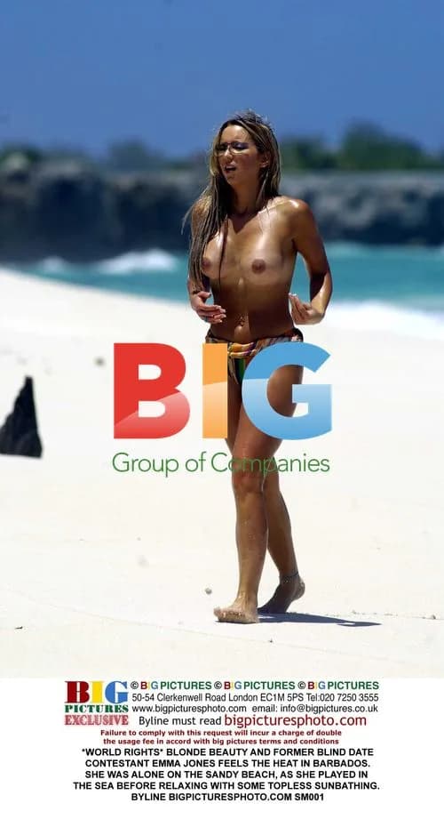 Emma Jones Sunbathes Topless in Barbados