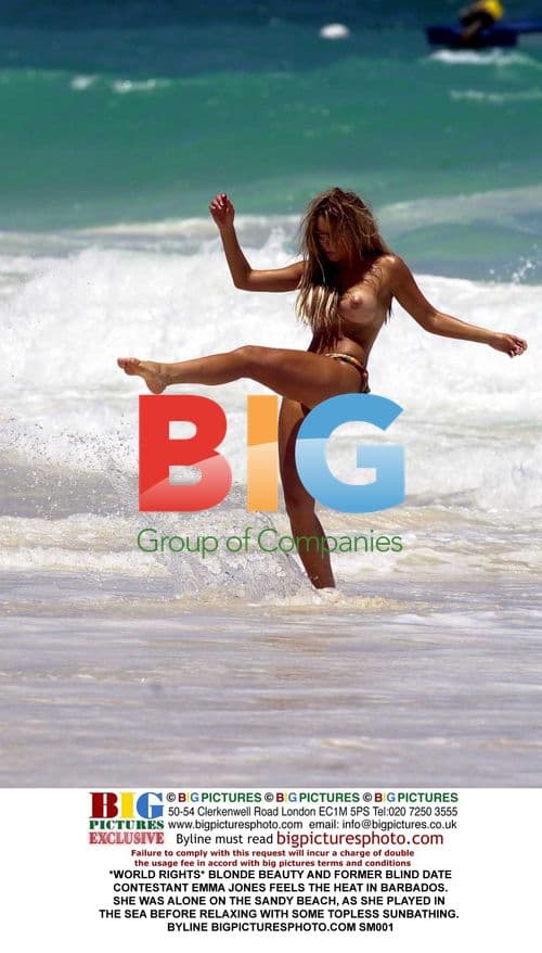 Emma Jones Sunbathes in Barbados