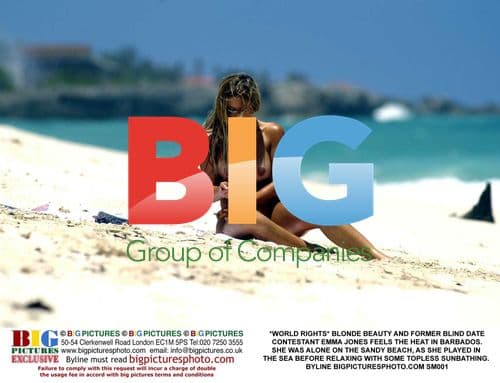 Emma Jones Sunbathes Topless in Barbados