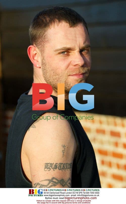 Brian Harvey's Head Scar