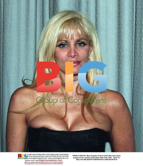 Victoria Gotti after heart surgery