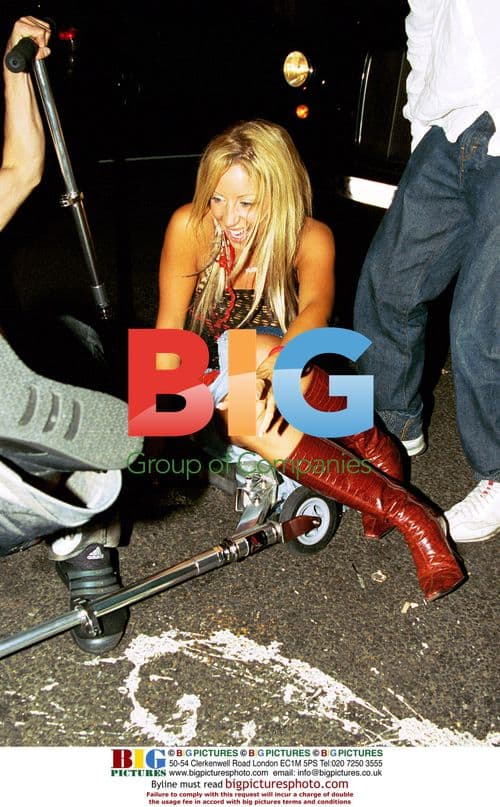 Emma Jones Falls Off Micro Scooter