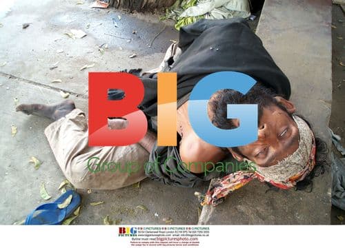 Drug addict unconscious on sidewalk in Karachi