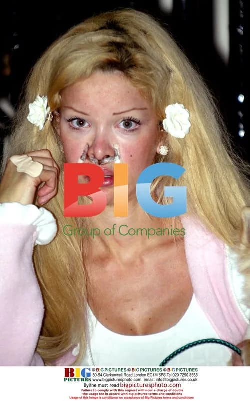 Alicia Douvall hides facial injury