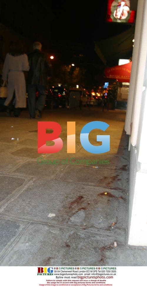 Tony De niro Assaulted at Club