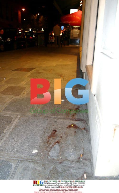 Tony De Niro Injured in Club Altercation