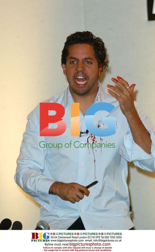 David Blaine cuts off ear at press conference