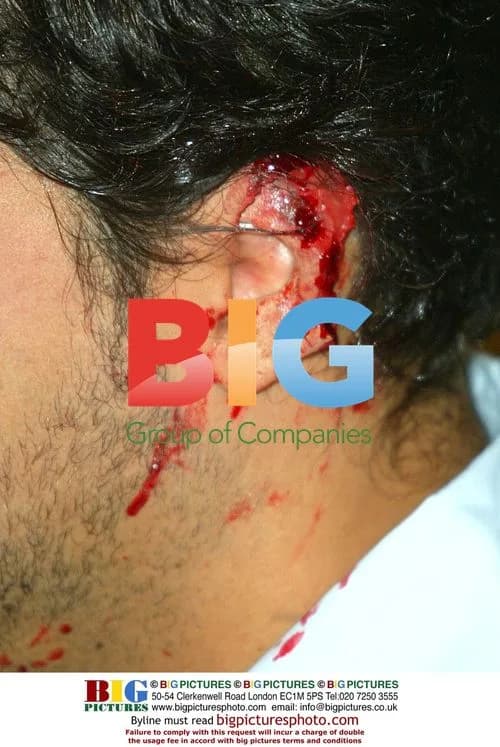 David Blaine Cuts Off Ear at Press Conference