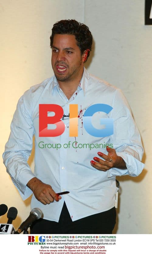 David Blaine cuts off ear at press conference