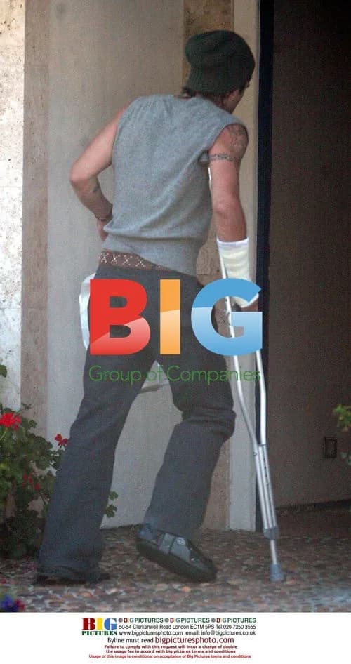 Colin Farrell Hobbled, but on the Mend