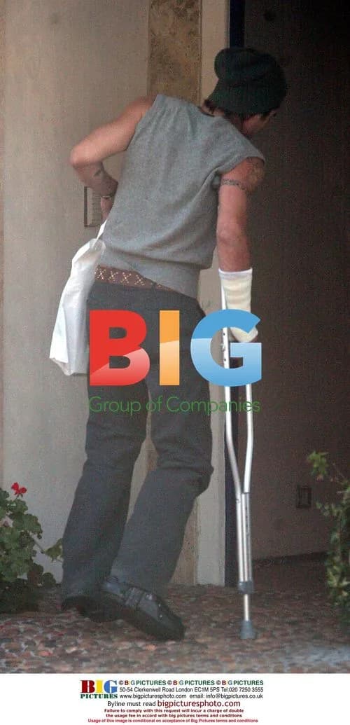 Colin Farrell Hobbled by Injury
