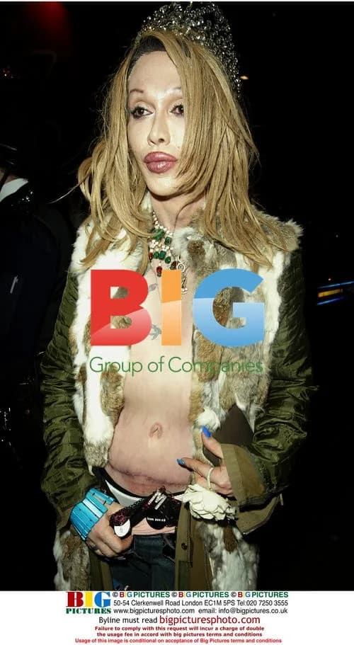 Pete Burns Arrested for Assault in London