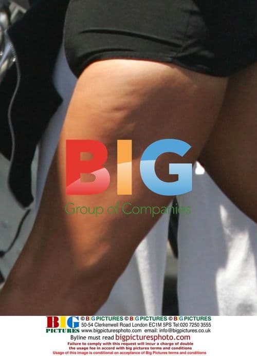 Paris Hilton's Cellulite Exposed