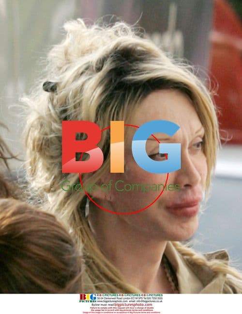 Pete Burns after plastic surgery visit