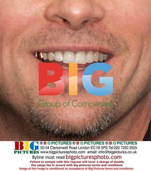 Brad Pitt Shows Off Gold Tooth