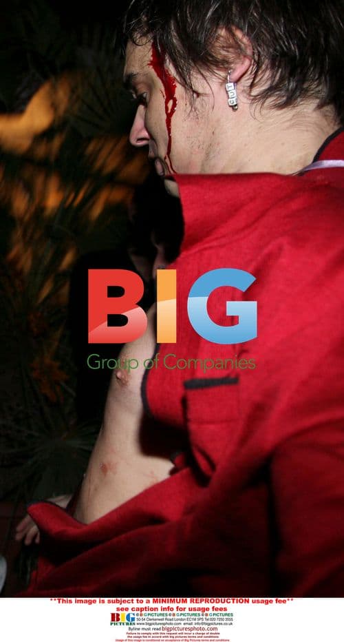 Pete Doherty involved in fight after concert