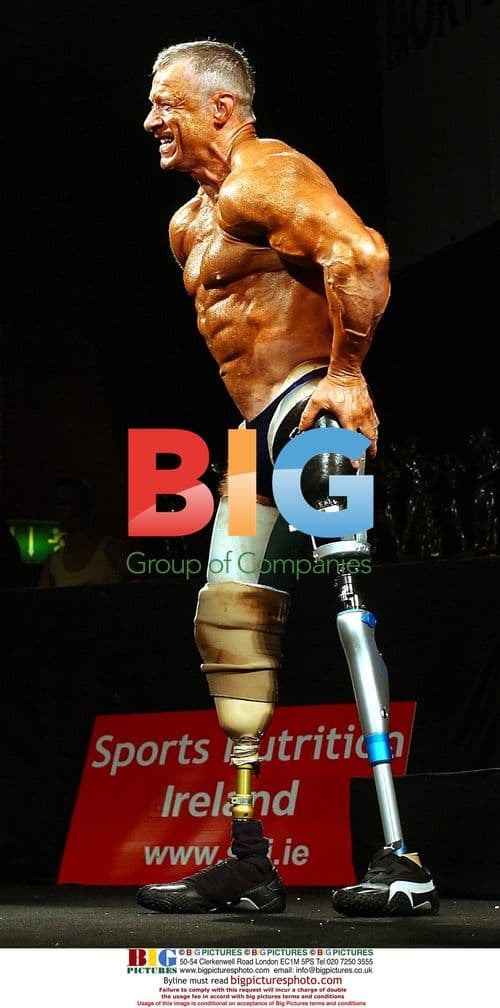 Amputee Michael Stewart at Mr. Ireland Universe