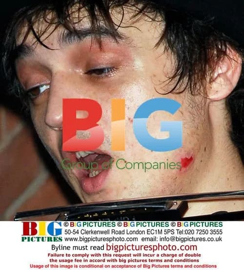 Pete Doherty Onstage, London 2007