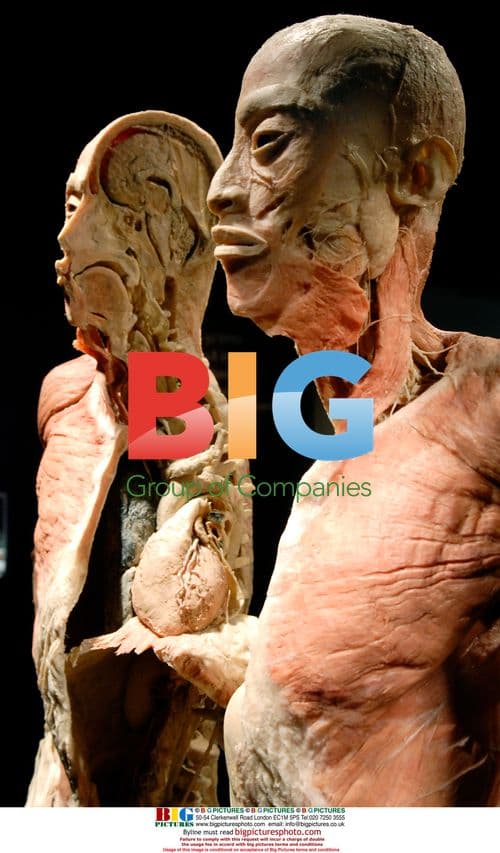 Dissected human specimen on display