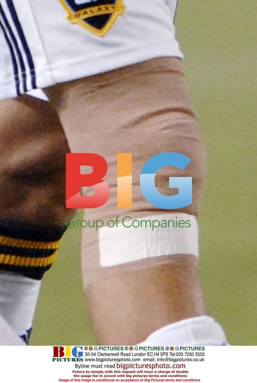 David Beckham leaves match with bandage