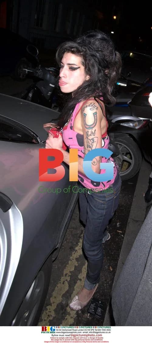 Amy Winehouse Sore Nostril After Dark Gig
