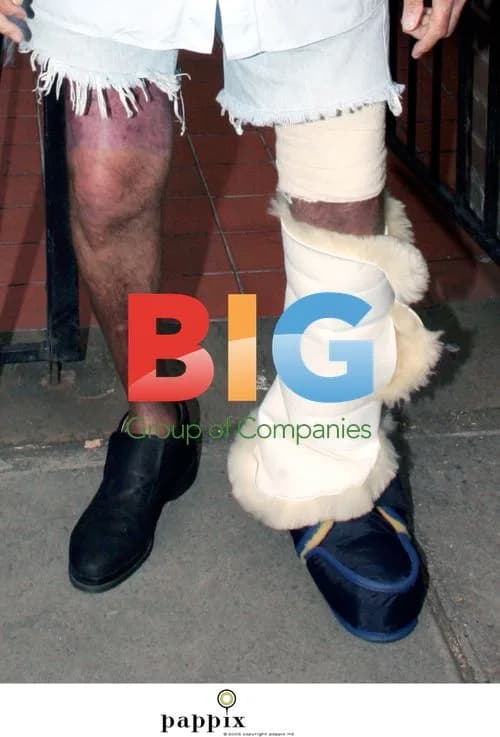 Michael Winner seen with bandaged leg and cane