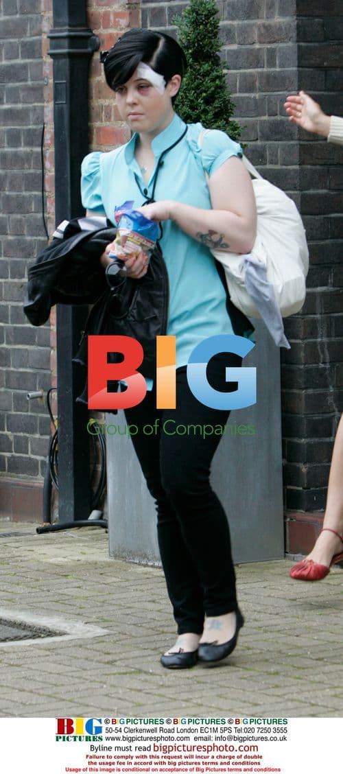 Kelly Osbourne leaves home for black eye