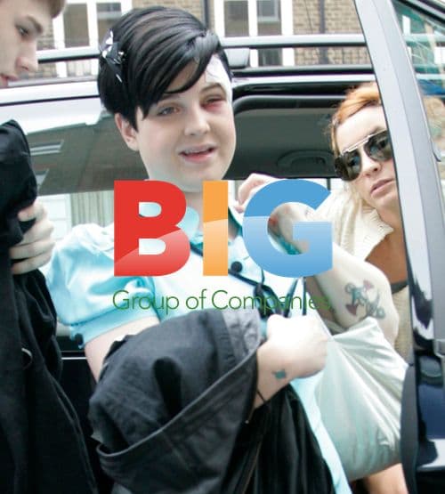 Kelly Osbourne Leaving Home to Check Black Eye