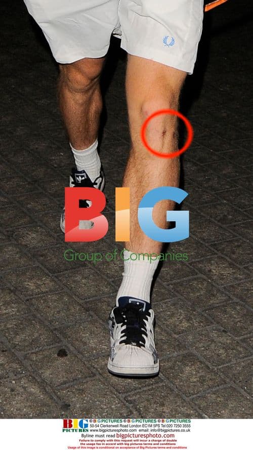 Andrew Murray Defeated at Wimbledon