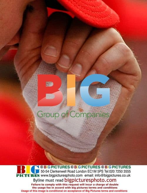 Rick Ankiel watches game from dugout