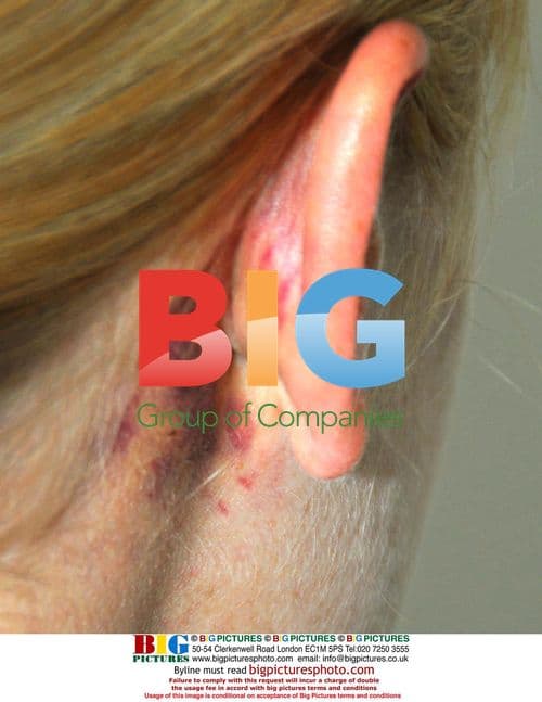 Victim of Violent Assault