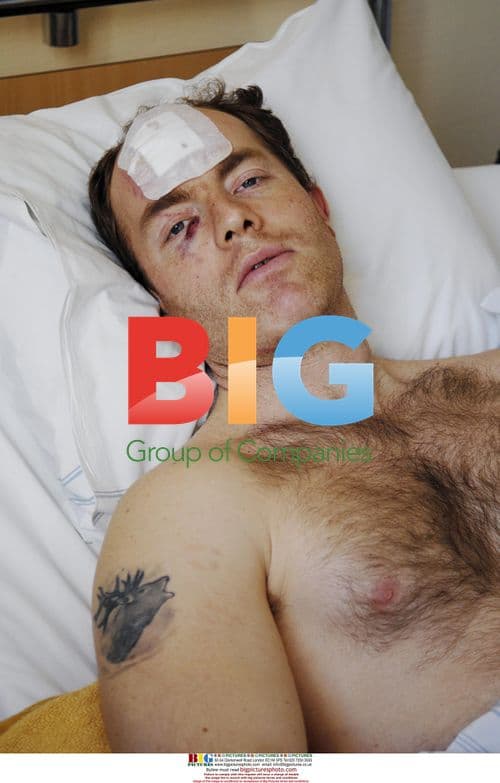 Forest worker attacked by bear in Sweden