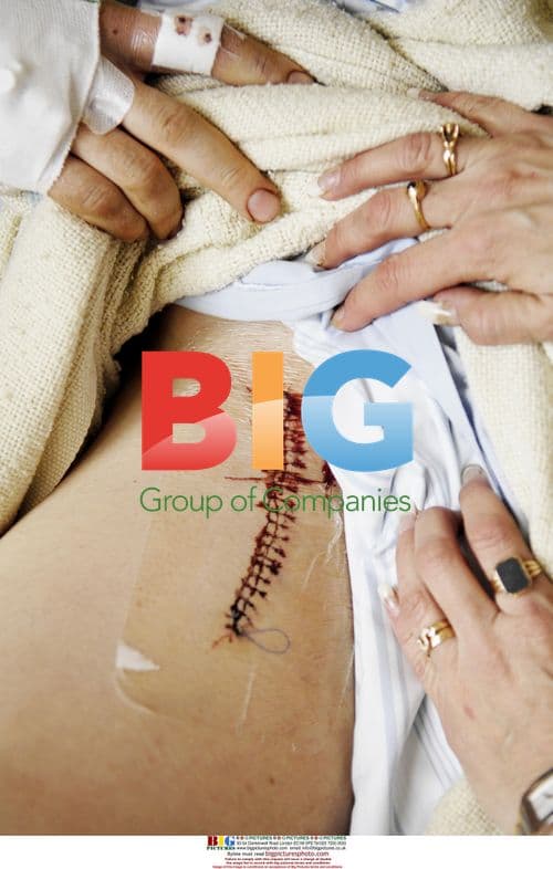 Worker Attacked by Bear in Sweden