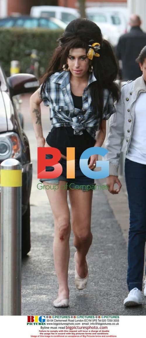 Amy Winehouse Spotted with Knee Gash