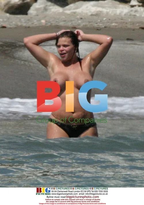 Jade Goody Enjoying Beach in Spain