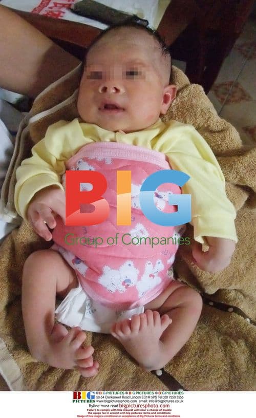 Woman gave birth to baby with 16 toes