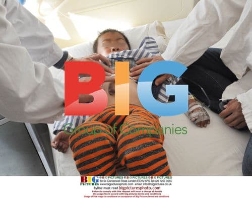 Boy Born With Protruding Heart