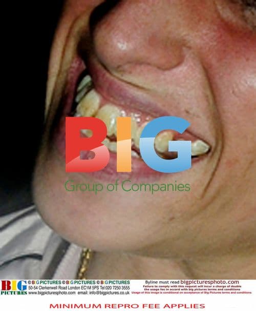 Amy Winehouse Heading to London Clinic